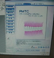 デジタル画像によるPMTCの説明